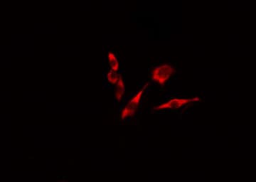 Polyclonal Rabbit anti-Human TNFSF13 / APRIL Antibody (IHC, IF, WB)