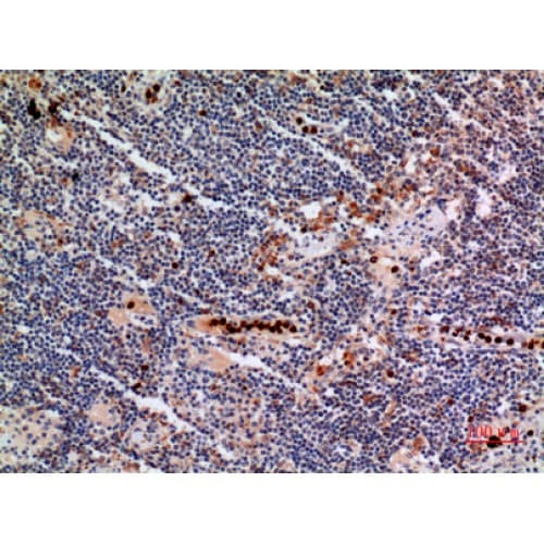 Polyclonal Rabbit anti-Human CYBB / NOX2 / gp91phox Antibody (Internal, IHC, WB)