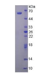Human ALDH1A1 / ALDH1 Protein (Recombinant His, N-Terminal)