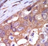 Polyclonal Rabbit anti-Human PRKD1 / PKC Mu Antibody (aa361-389, IHC, WB)