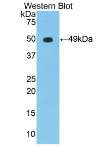 ENO2 / NSE Antibody (aa2-434, APC)