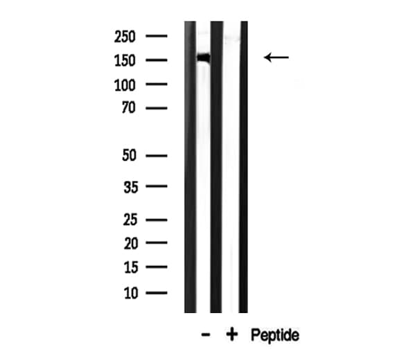 CHAF1A / CAF1 Antibody