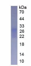 Human FNDC5 / Irisin Protein (Recombinant His, N-Terminal)