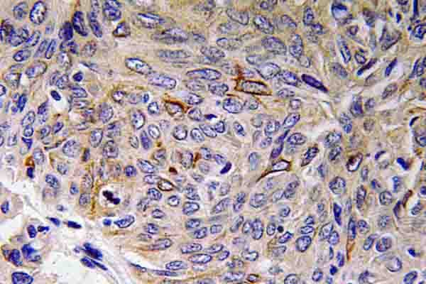 IL32 Antibody (Lys226)