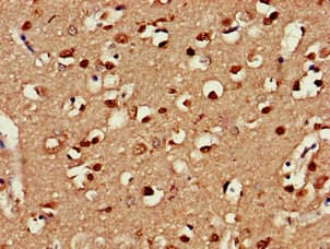 Polyclonal Rabbit anti-Human CLINT1 Antibody (IHC, WB)