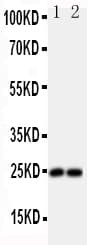 FGF19 Antibody (aa124-140)
