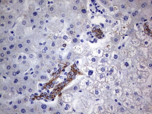 Acidic Cytokeratin Antibody (clone 8A3)