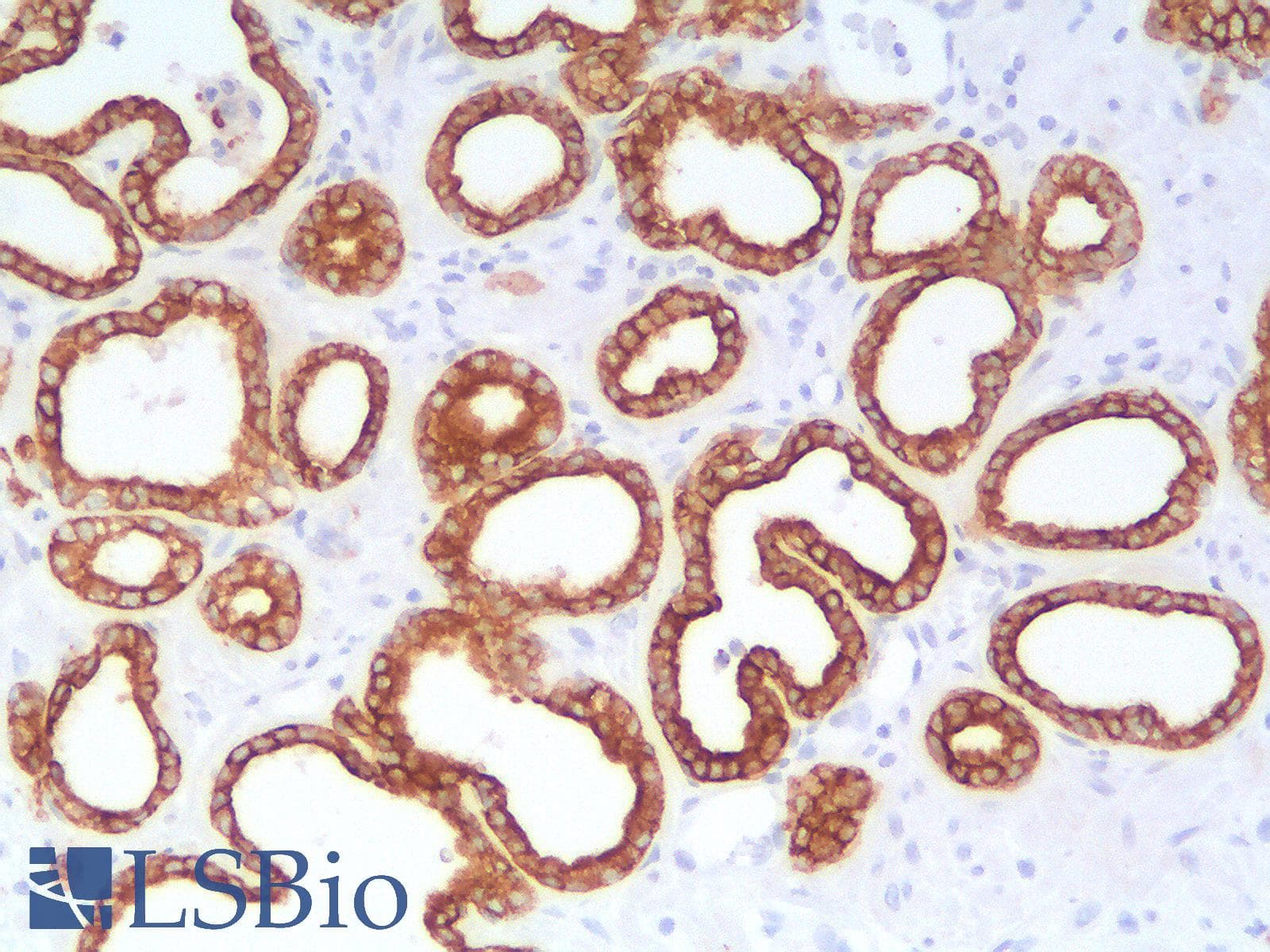 PathPlus™ KRT19 / CK19 / Cytokeratin 19 Antibody (clone rKRT19/799)