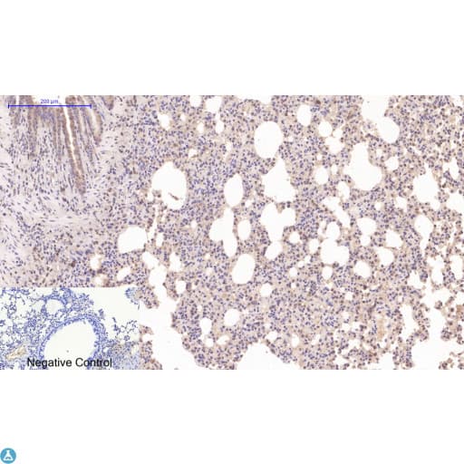 DES / Desmin Antibody