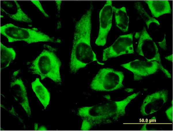 RPLP0 Antibody (clone 1B4)