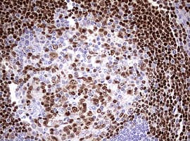 PAX5 Antibody (clone OTI6B6)