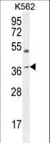 Polyclonal Rabbit anti-Human APOL6 / Apolipoprotein L 6 Antibody (aa126-155, IHC, WB)