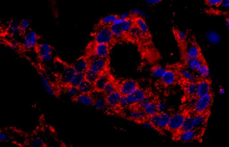 Polyclonal Rabbit anti-Human SNX1 Antibody (aa475-C-term, IHC, WB)
