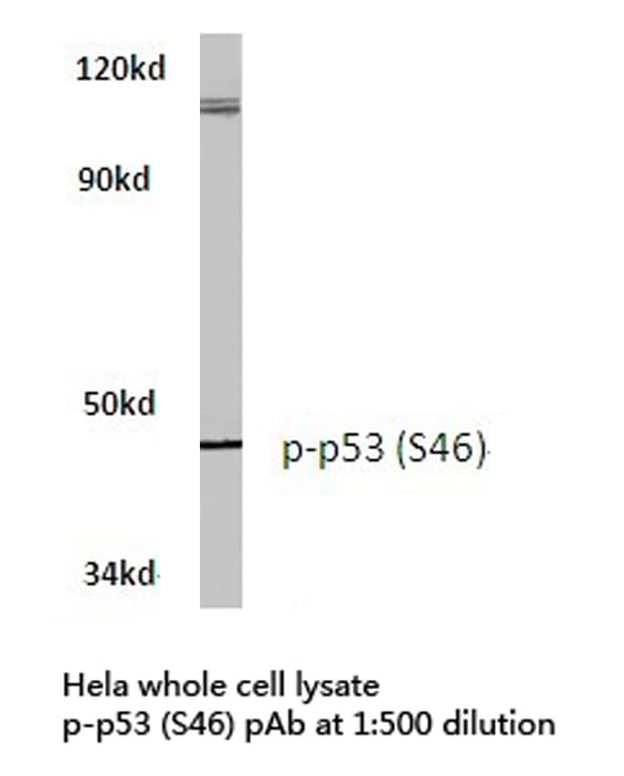 TP53 / p53 Antibody (phospho-Ser46)