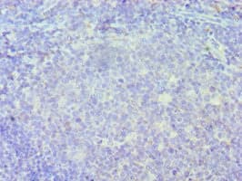 ICSBP / IRF8 Antibody (aa137-426)