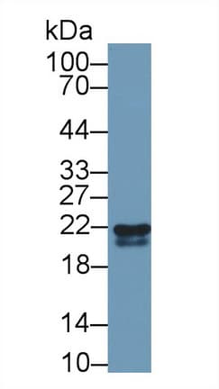 RBP4 Antibody (aa1-183)