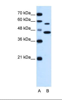 SLC39A5 / ZIP5 Antibody (N-Terminus)