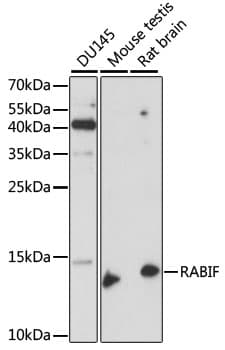 Polyclonal Rabbit anti-Human RABIF Antibody (WB)