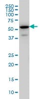 Monoclonal Mouse anti-Human EHD3 Antibody (clone 4B7, IHC, IF, WB)