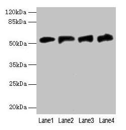 Polyclonal Rabbit anti-Human FDXR Antibody (IHC, WB)