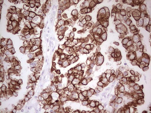 ABCB1 / MDR1 / P Glycoprotein Antibody (aa995-1280, clone OTI1A7, Carrier-free)