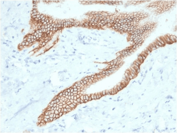 TROP2 / TACSTD2 Antibody (clone TACSTD2/2153)