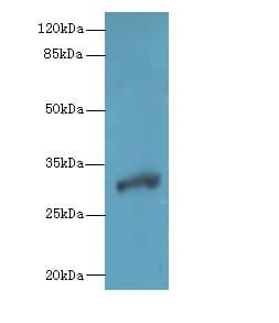 DHRS12 Antibody