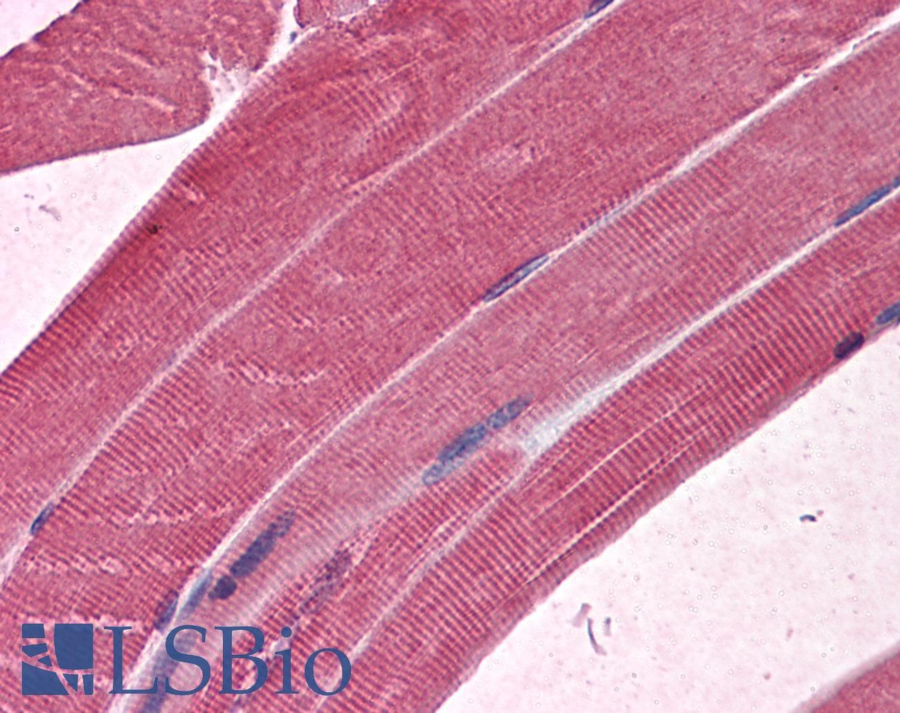 IHC-plus™ MBNL1 / MBNL Antibody (clone 3E7)