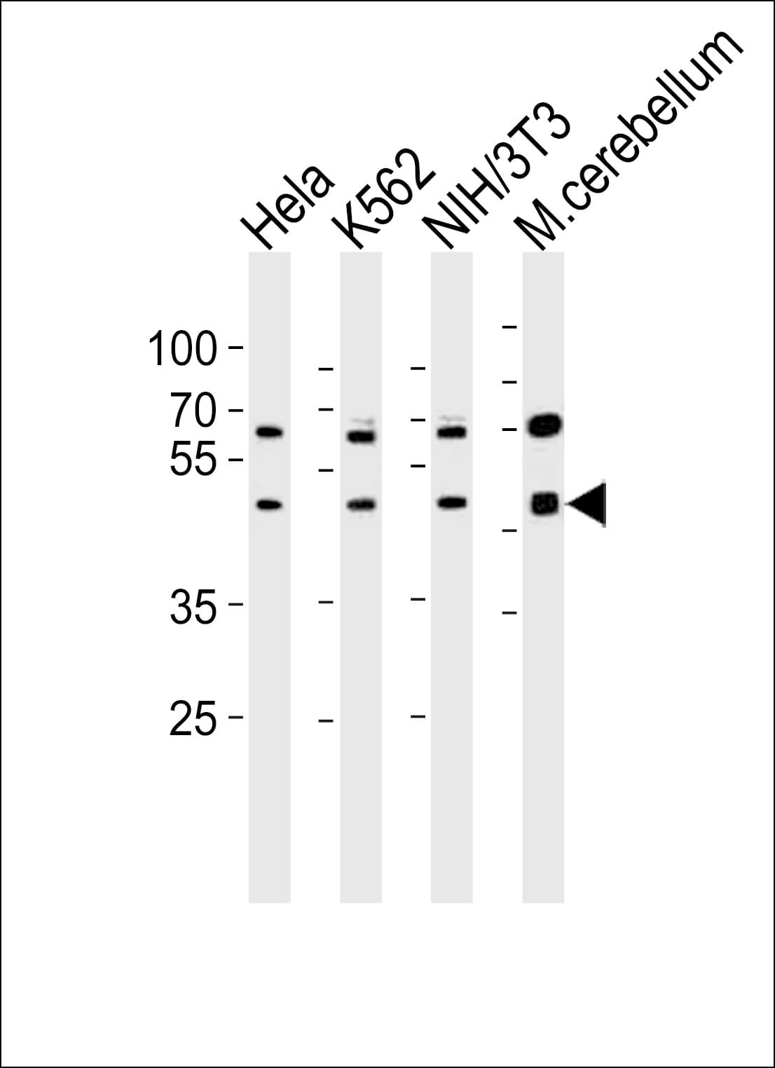 BAF53 / ACTL6A Antibody (aa295-330)