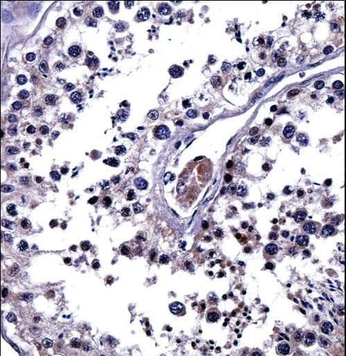 IL25 / IL17E Antibody (aa76-104)