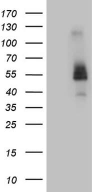 FCRLB / FREB-2 Antibody (aa202-426, clone OTI5H6)