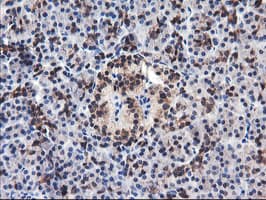 FBXO21 Antibody (clone OTI1E1)