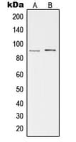 PRKG2 / CGKII Antibody (Internal)