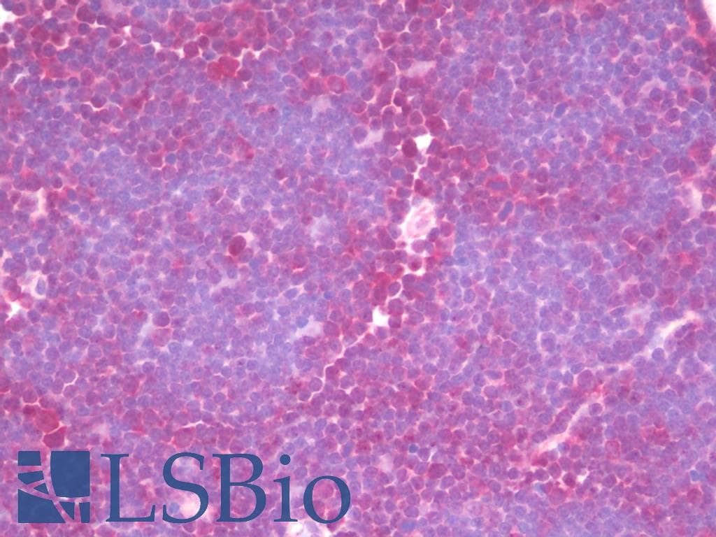 IHC-plus™ DIS3 Antibody