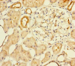 Polyclonal Rabbit anti-Human MTHFD2 Antibody (IHC, WB)