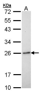 IHC-plus™ RAB6A / RAB6 Antibody (aa1-208)