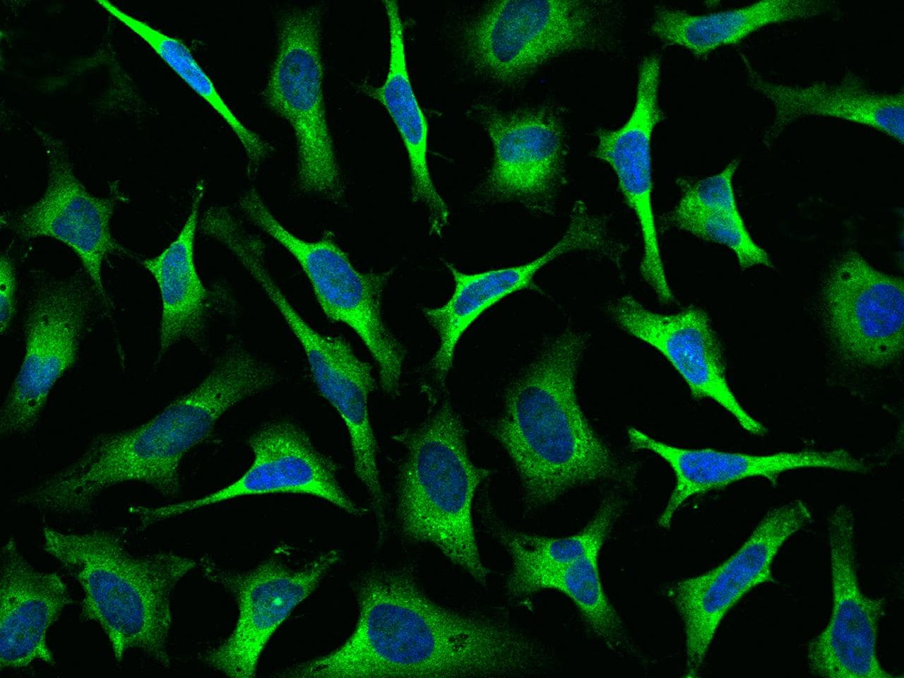 KARS Antibody (Preservative Free)