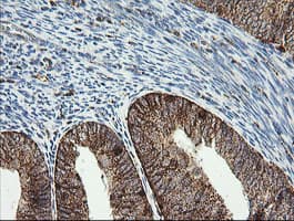 PIK3CG / PI3K Gamma Antibody (clone OTI4B9)