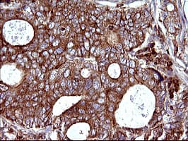 SCAMP2 Antibody (clone OTI3C2)