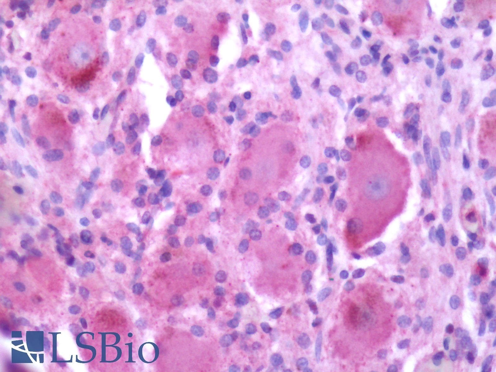 IHC-plus™ MRGPRX2 / MRGX2 Antibody (Extracellular Domain)