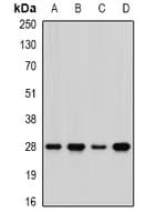 Polyclonal Rabbit anti-Human PHAP1 / ANP32A Antibody (IHC, WB)