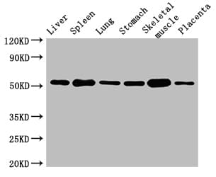 GLP1R / GLP-1 Receptor Antibody