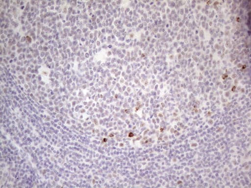 MALT1 Antibody (clone OTI3A2)