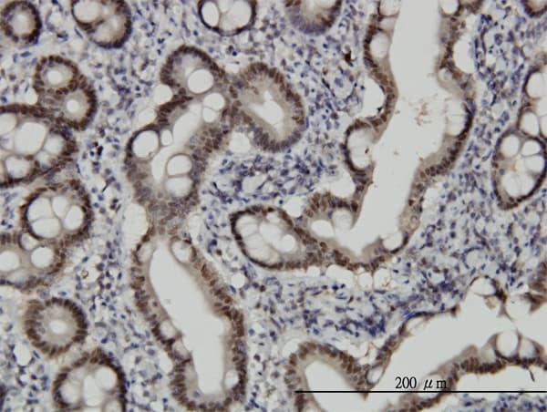 CHFR Antibody (clone 1H3-A12)