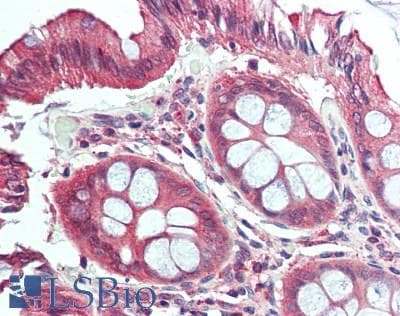 IHC-plus™ Polyclonal Rabbit anti-Human KIDINS220 / ARMS Antibody (aa1706-1771, IHC, WB)