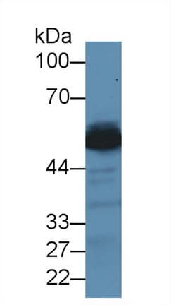 GPT / Alanine Transaminase Antibody (aa147-263, APC, Cy7)