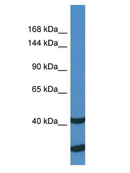 UBE3C Antibody (aa1-50)