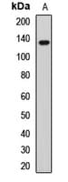 TTBK2 Antibody