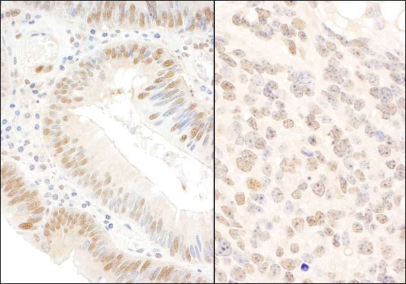Polyclonal Rabbit anti-Human BOP1 Antibody (aa350-400, IHC, WB)