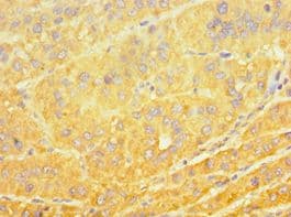 CYP4A11 Antibody (aa1-200)